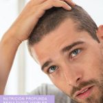 suplemento para evitar la caida del cabello